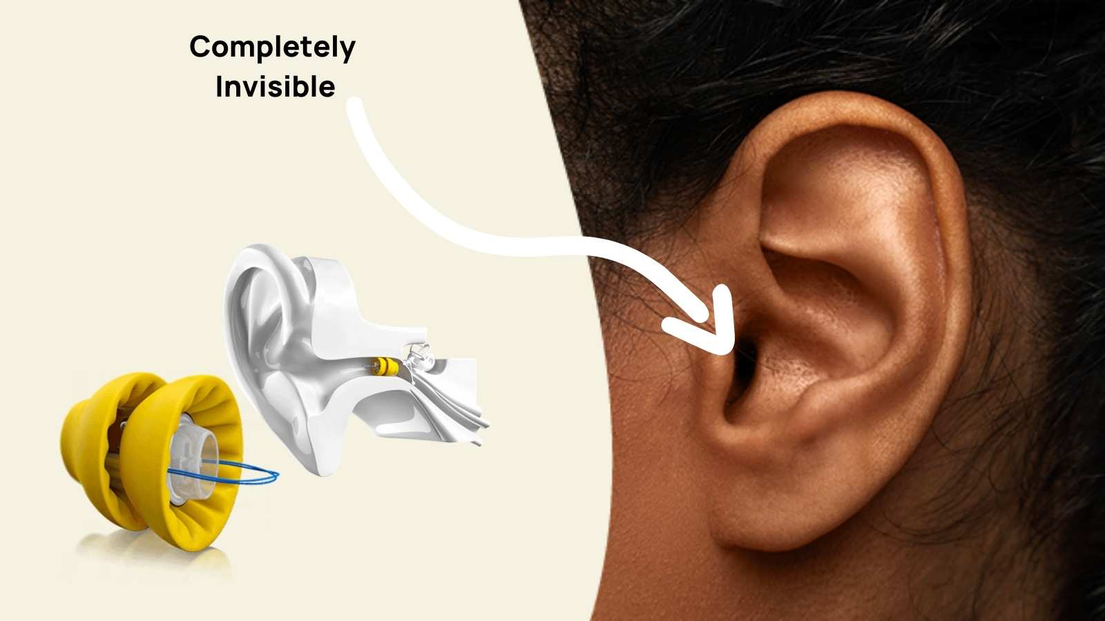 Best Tinnitus Masking Hearing Aids and in 2023