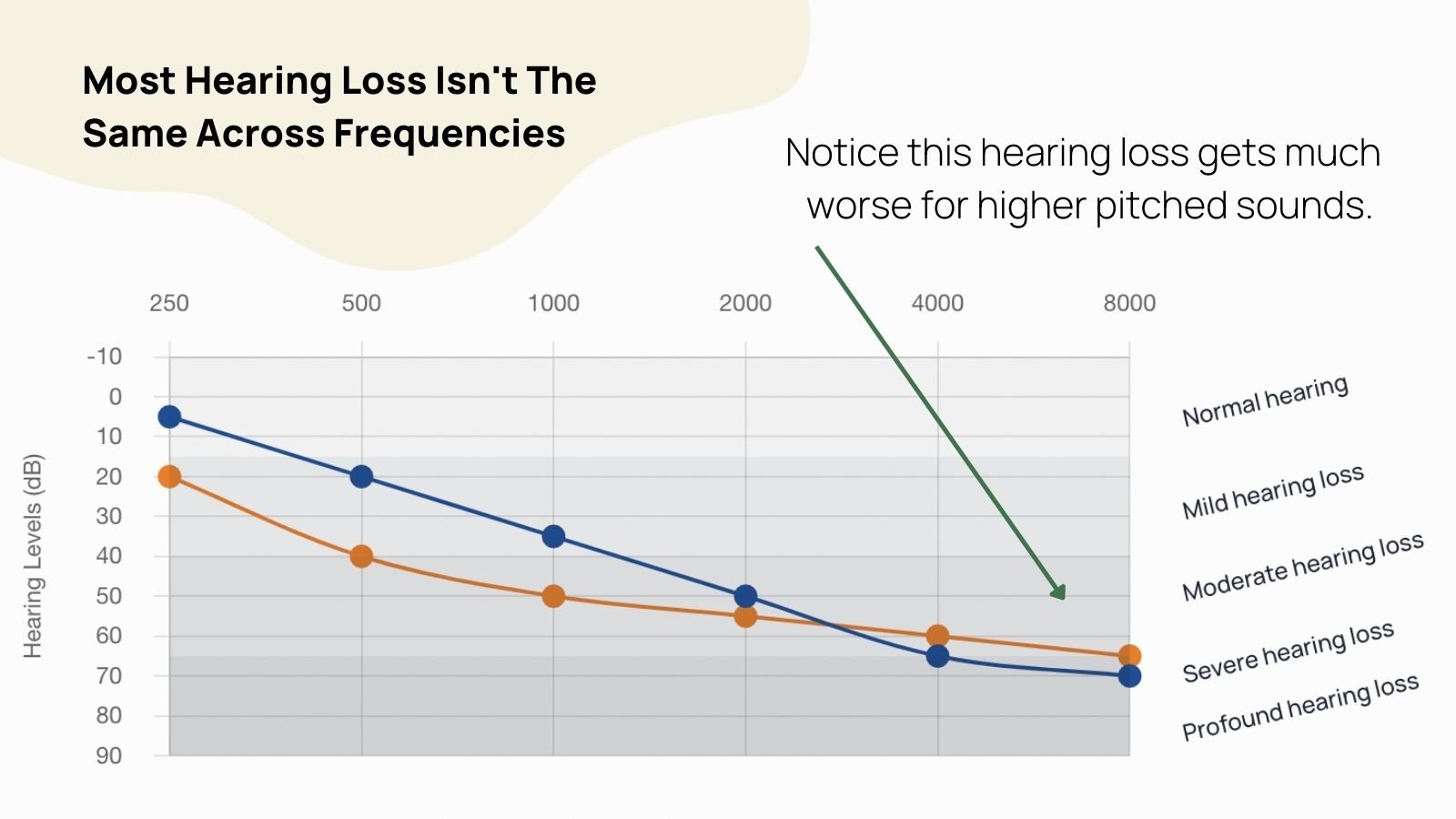 Audiogram of a sloping hearing loss